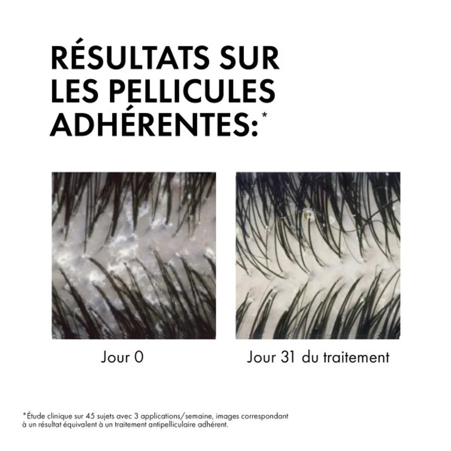 Vichy Dercos Eco-Recharge Shampoing Anti-Pelliculaire 500ml Cheveux Secs Éco-Responsable Durable - globalparapharmacie