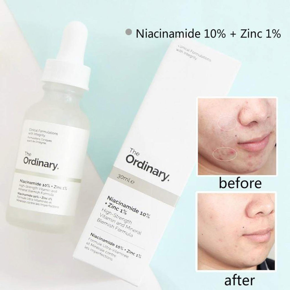 Ordinary Niacinamide 10% + Zinc 1% 30ml