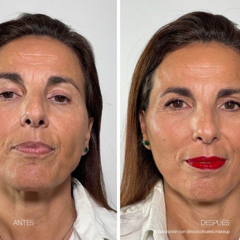 LaCabine Flash Effect Ampoule 10x2ml - Global Para